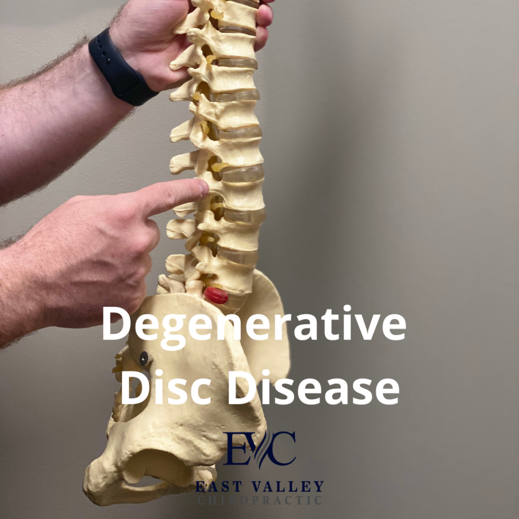 Degenerative disc